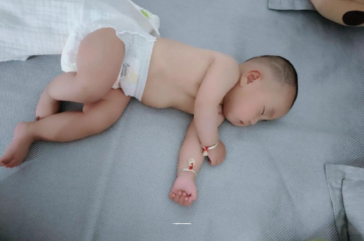 合肥宝宝头上长痱子 合肥宝宝头上长痱子